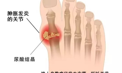 病人死在手术台上还交手术费吗-病人手术台上死了网 - 为你提供病人死在手术室、病人死在手术台上是否算医疗事故